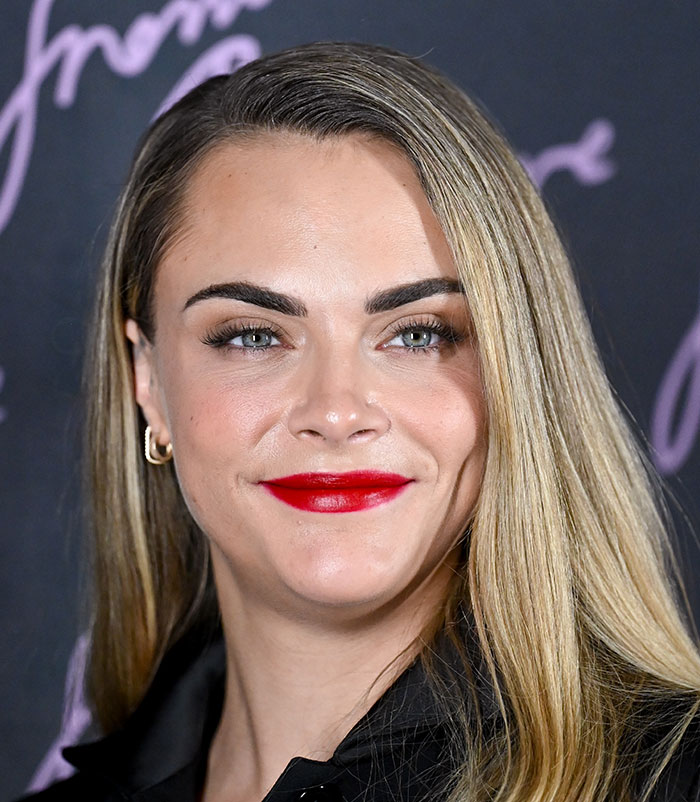 50+ Photos Of Celebrities&rsquo; Skins Up Close That Show They&rsquo;re Human Just Like Us