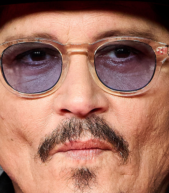 50+ Photos Of Celebrities&rsquo; Skins Up Close That Show They&rsquo;re Human Just Like Us