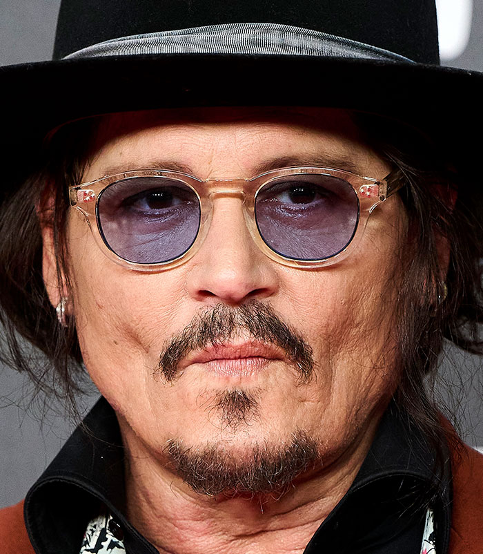 50+ Photos Of Celebrities&rsquo; Skins Up Close That Show They&rsquo;re Human Just Like Us