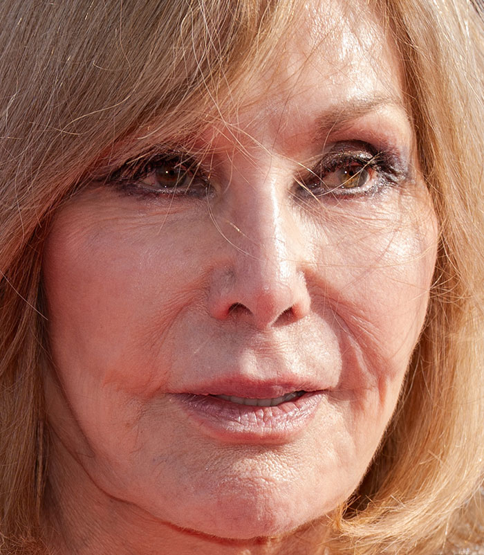 50+ Photos Of Celebrities&rsquo; Skins Up Close That Show They&rsquo;re Human Just Like Us