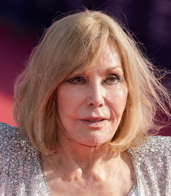 50+ Photos Of Celebrities&rsquo; Skins Up Close That Show They&rsquo;re Human Just Like Us