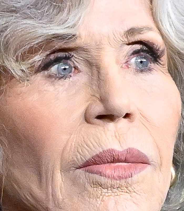 50+ Photos Of Celebrities&rsquo; Skins Up Close That Show They&rsquo;re Human Just Like Us