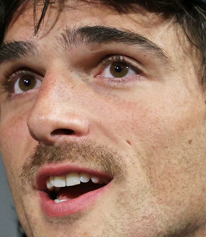 50+ Photos Of Celebrities&rsquo; Skins Up Close That Show They&rsquo;re Human Just Like Us