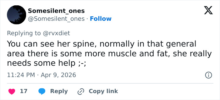 18-Year-Old K-Pop Star Sparks Major Health Concerns After Fans Notice Extremely Thin Appearance