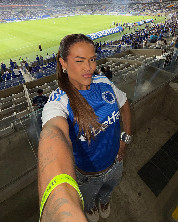 This Influencer Removed A Vein From Her Forehead Because It Bothered Her Aesthetically And Shared The Results