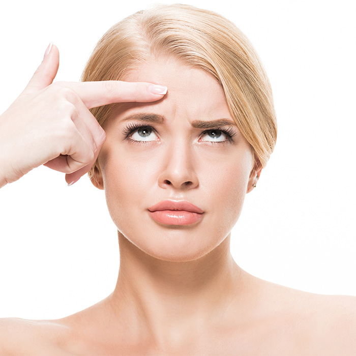 This Influencer Removed A Vein From Her Forehead Because It Bothered Her Aesthetically And Shared The Results