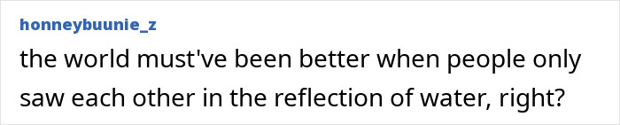 This Influencer Removed A Vein From Her Forehead Because It Bothered Her Aesthetically And Shared The Results