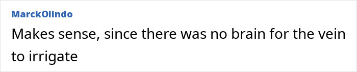 This Influencer Removed A Vein From Her Forehead Because It Bothered Her Aesthetically And Shared The Results