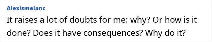 This Influencer Removed A Vein From Her Forehead Because It Bothered Her Aesthetically And Shared The Results