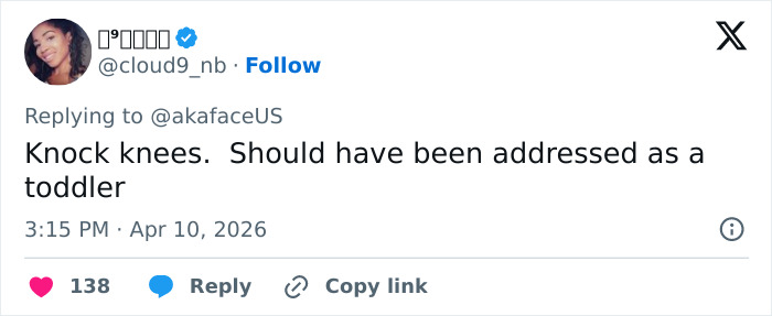 “The Queen Of K-Legs”: Kim Kardashian&rsquo;s Daughter Sparks Concern As Fans Notice How She Walks