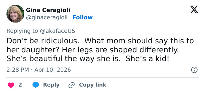 “The Queen Of K-Legs”: Kim Kardashian&rsquo;s Daughter Sparks Concern As Fans Notice How She Walks