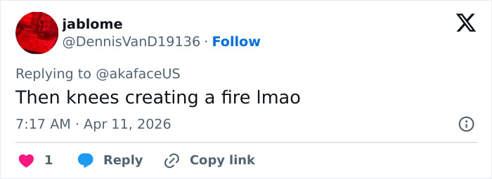 “The Queen Of K-Legs”: Kim Kardashian&rsquo;s Daughter Sparks Concern As Fans Notice How She Walks