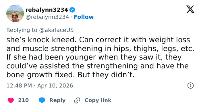 “The Queen Of K-Legs”: Kim Kardashian&rsquo;s Daughter Sparks Concern As Fans Notice How She Walks