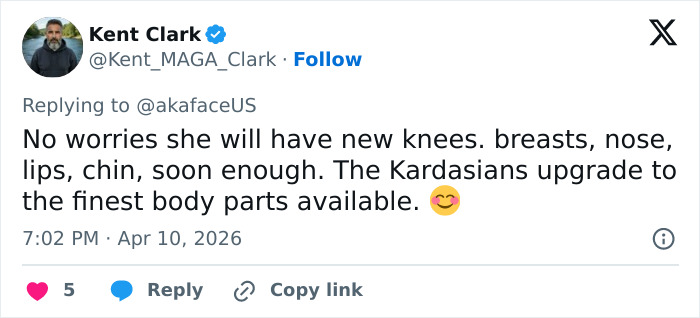 “The Queen Of K-Legs”: Kim Kardashian&rsquo;s Daughter Sparks Concern As Fans Notice How She Walks