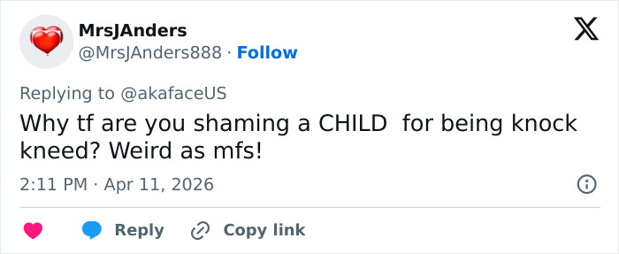 “The Queen Of K-Legs”: Kim Kardashian&rsquo;s Daughter Sparks Concern As Fans Notice How She Walks