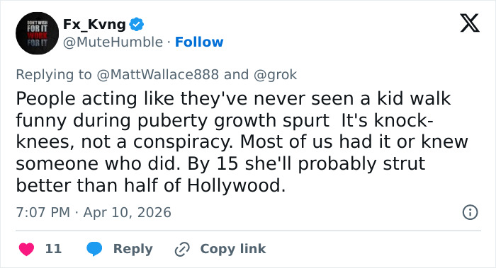 “The Queen Of K-Legs”: Kim Kardashian&rsquo;s Daughter Sparks Concern As Fans Notice How She Walks