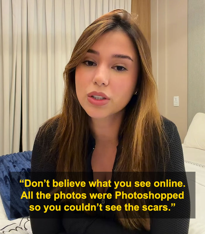 “Puts Things Into Perspective”: Influencer Reveals The Botched Plastic Surgery She Had Been Hiding With Photoshop For Years