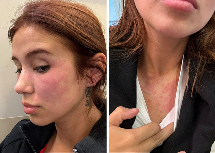 “Puts Things Into Perspective”: Influencer Reveals The Botched Plastic Surgery She Had Been Hiding With Photoshop For Years