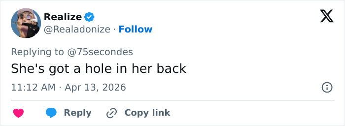 “Puts Things Into Perspective”: Influencer Reveals The Botched Plastic Surgery She Had Been Hiding With Photoshop For Years