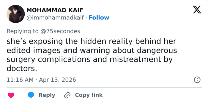 “Puts Things Into Perspective”: Influencer Reveals The Botched Plastic Surgery She Had Been Hiding With Photoshop For Years