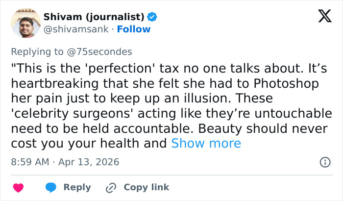 “Puts Things Into Perspective”: Influencer Reveals The Botched Plastic Surgery She Had Been Hiding With Photoshop For Years