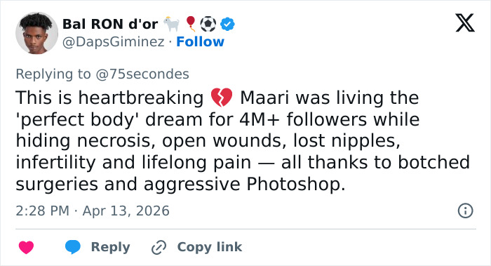 “Puts Things Into Perspective”: Influencer Reveals The Botched Plastic Surgery She Had Been Hiding With Photoshop For Years