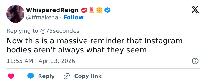 “Puts Things Into Perspective”: Influencer Reveals The Botched Plastic Surgery She Had Been Hiding With Photoshop For Years