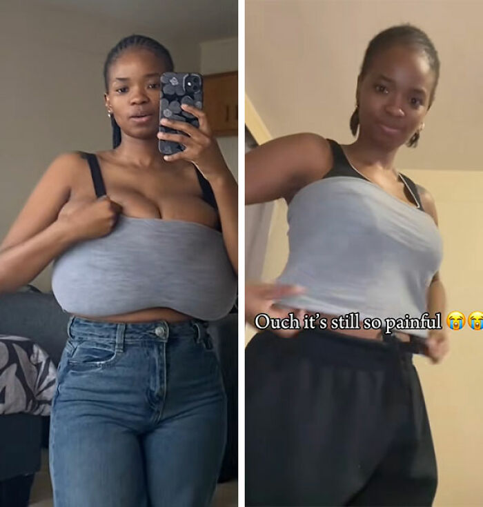 Woman&rsquo;s Breasts Regrow After Undergoing Reduction, Leaving Internet Baffled