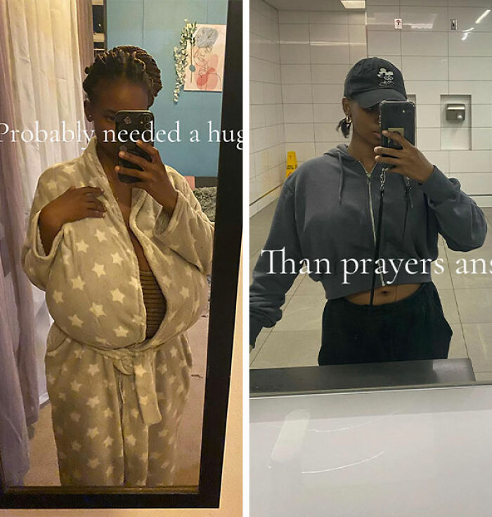 Woman&rsquo;s Breasts Regrow After Undergoing Reduction, Leaving Internet Baffled