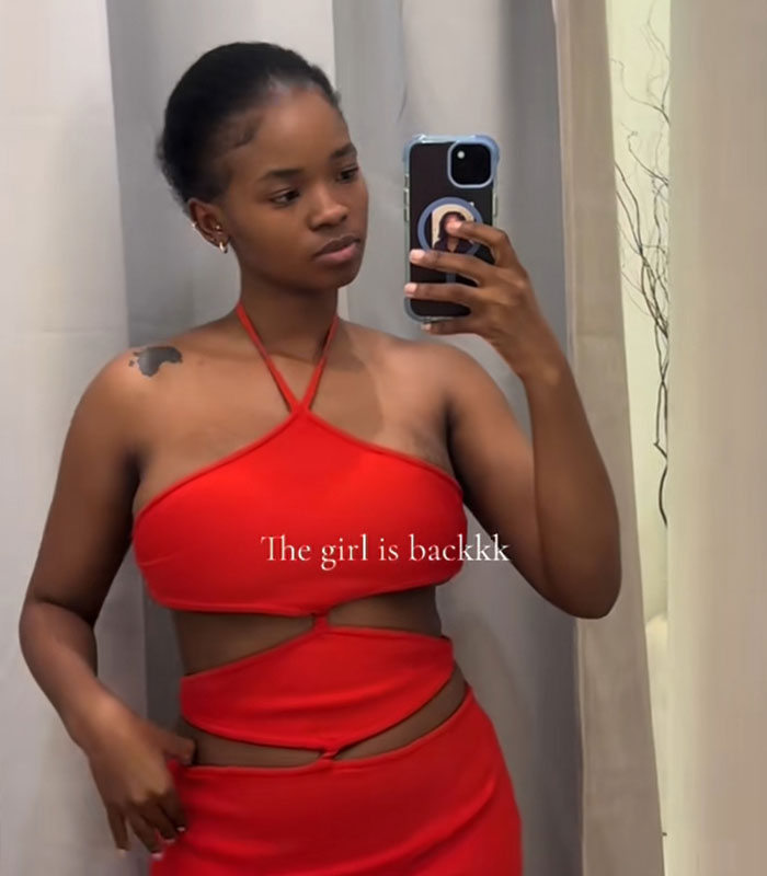 Woman&rsquo;s Breasts Regrow After Undergoing Reduction, Leaving Internet Baffled