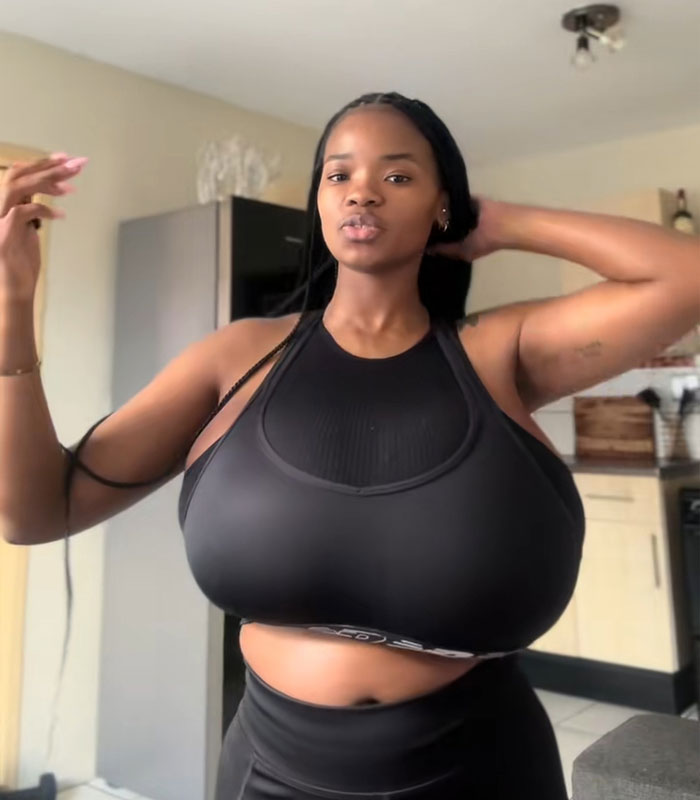Woman&rsquo;s Breasts Regrow After Undergoing Reduction, Leaving Internet Baffled