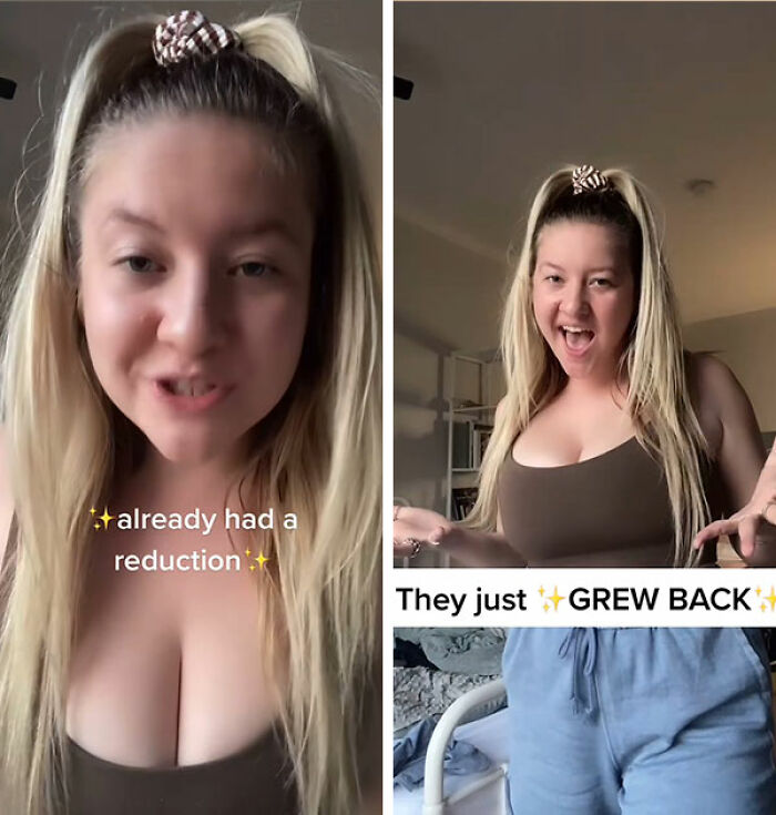 Woman&rsquo;s Breasts Regrow After Undergoing Reduction, Leaving Internet Baffled