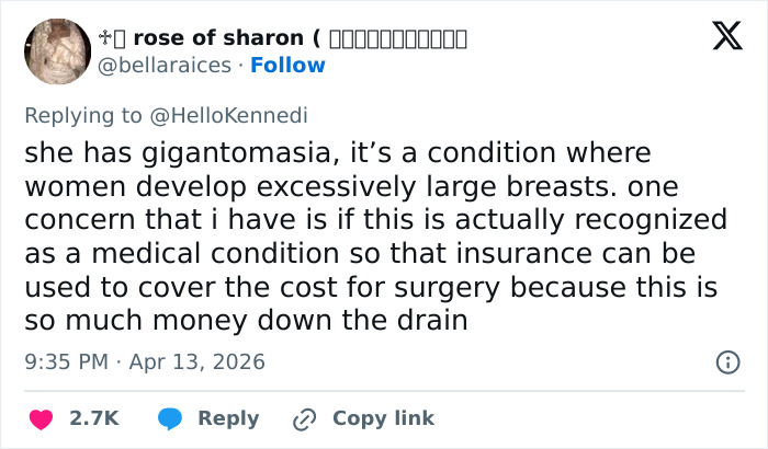 Woman&rsquo;s Breasts Regrow After Undergoing Reduction, Leaving Internet Baffled