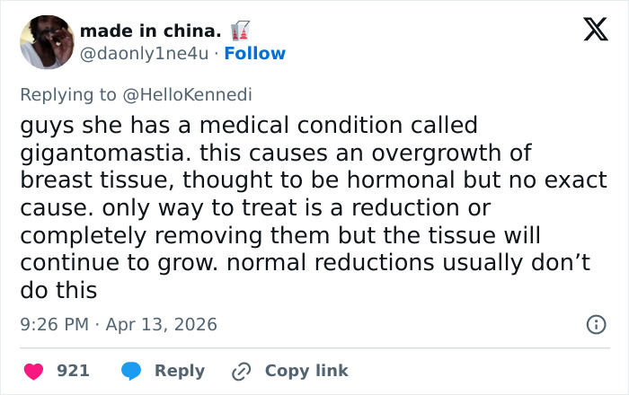 Woman&rsquo;s Breasts Regrow After Undergoing Reduction, Leaving Internet Baffled