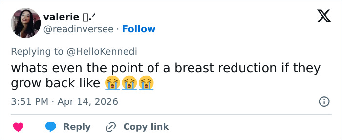 Woman&rsquo;s Breasts Regrow After Undergoing Reduction, Leaving Internet Baffled