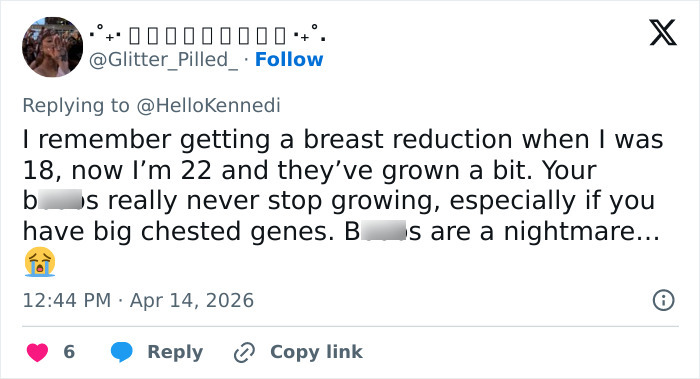 Woman&rsquo;s Breasts Regrow After Undergoing Reduction, Leaving Internet Baffled