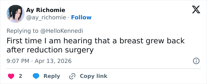 Woman&rsquo;s Breasts Regrow After Undergoing Reduction, Leaving Internet Baffled