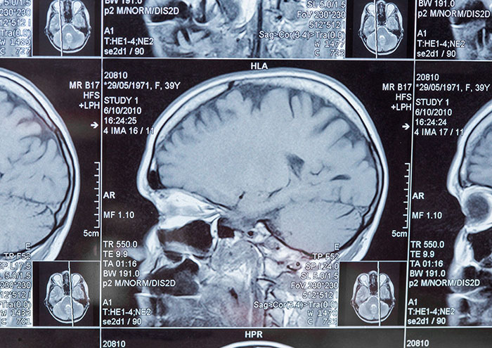 49 Scientists Share Their Biggest Theories That Are Not Yet Proven