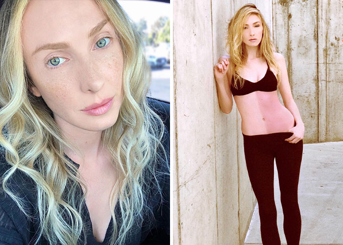 17 Bizarre Medical Problems And Mysteries That Catapulted People Into The News