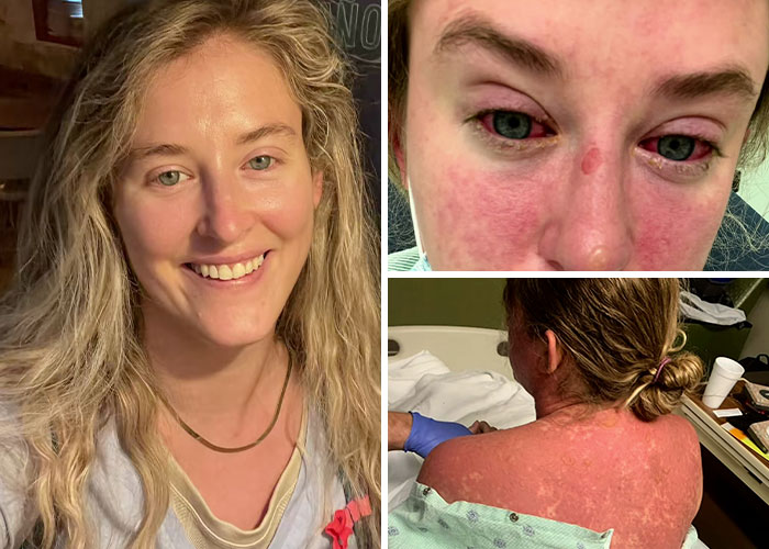 17 Bizarre Medical Problems And Mysteries That Catapulted People Into The News