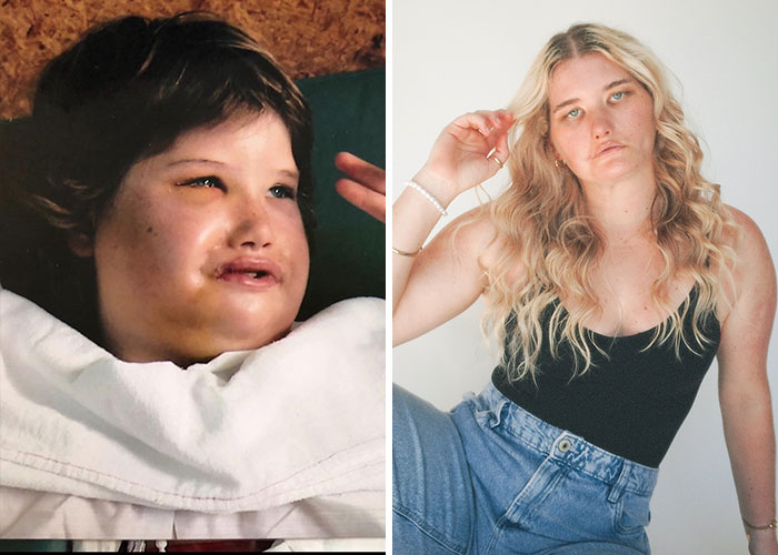 17 Bizarre Medical Problems And Mysteries That Catapulted People Into The News