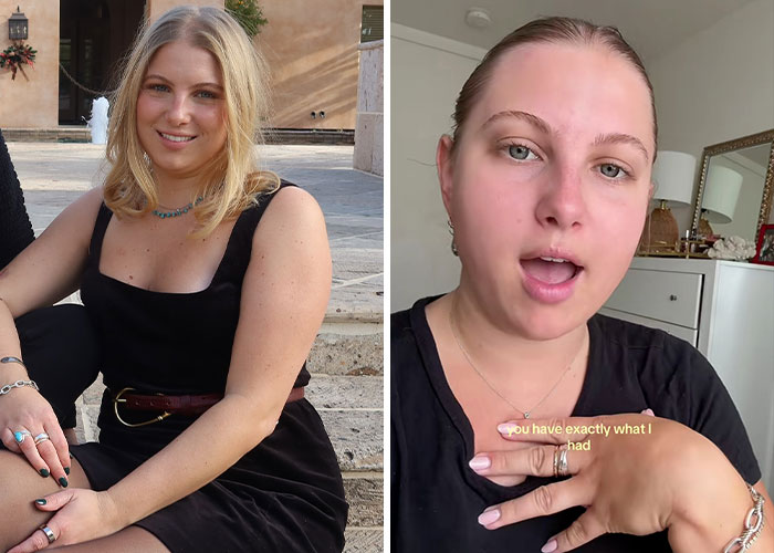 17 Bizarre Medical Problems And Mysteries That Catapulted People Into The News