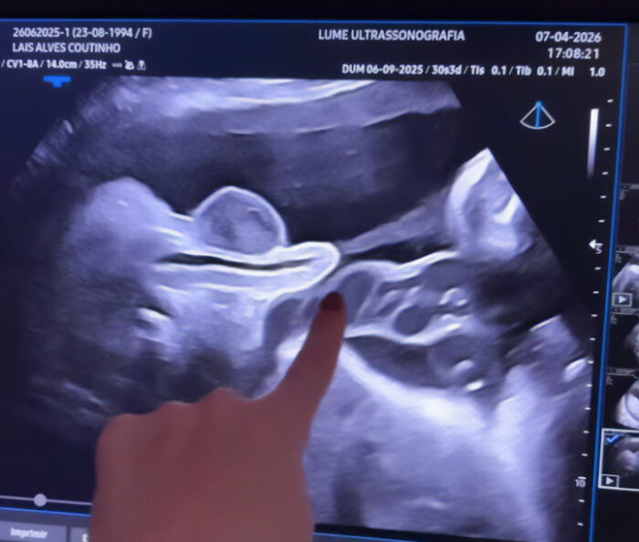 Pregnant Doctor Shows Her Own Baby Peeing Inside The Womb In Mind-Blowing Viral Video