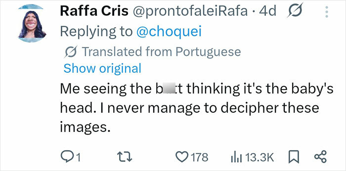 Pregnant Doctor Shows Her Own Baby Peeing Inside The Womb In Mind-Blowing Viral Video