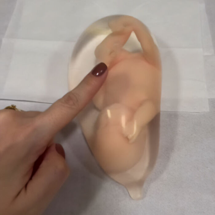 Pregnant Doctor Shows Her Own Baby Peeing Inside The Womb In Mind-Blowing Viral Video