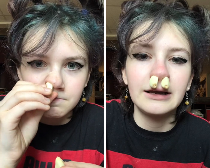 Brandi Glanville Rushed To Urgent Care After Trying Dangerous TikTok Medical Trend