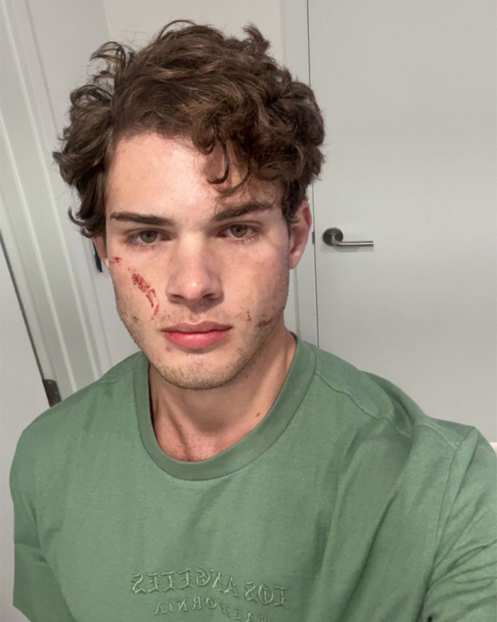 ‘Looksmaxxing’ Influencer Clavicular Breaks Silence After ‘Brutal’ Hospitalization Following Live Incident ‘Looksmaxxing’ Influencer Clavicular Breaks Silence After ‘Brutal’ Hospitalization Following Live Incident