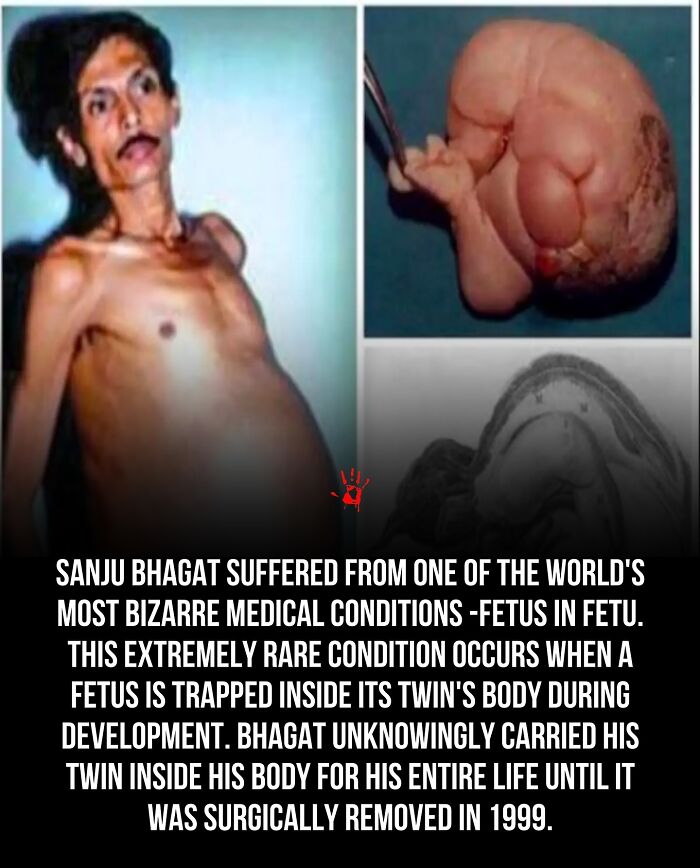 “Her Fate Remains A Mystery”: 94 People Share Creepy And Mysterious Things They Lose Sleep Over