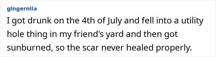 &ldquo;Just To Prove I Was Tough&rdquo;: Everyone Makes Mistakes, But These 47 People&rsquo;s Stupid Injury Stories Hurt To Read