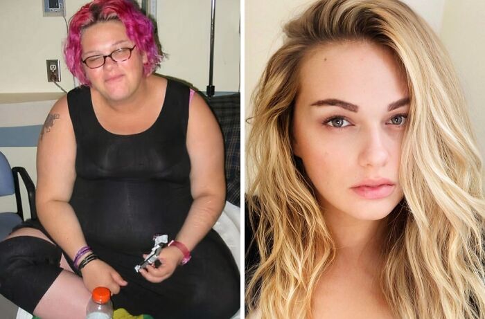 &ldquo;There Is Hope&rdquo;: 57 Glow-Ups So Extreme, People Barely Look Like The Same Person